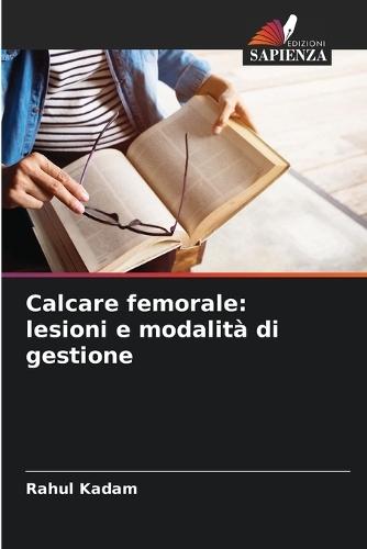 Calcare femorale: lesioni e modalità di gestione