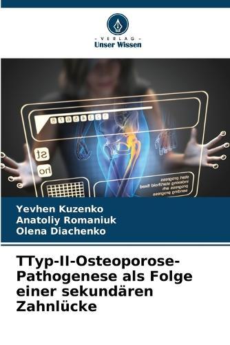 ТTyp-II-Osteoporose-Pathogenese als Folge einer sekundären Zahnlücke