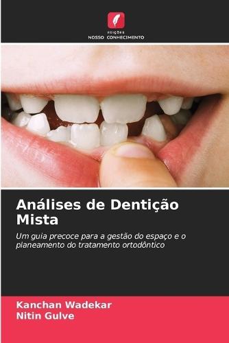 An�lises de Denti��o Mista