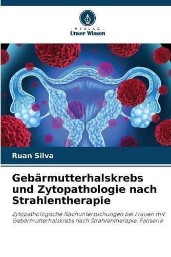 Gebärmutterhalskrebs und Zytopathologie nach Strahlentherapie