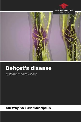 Behçet's disease