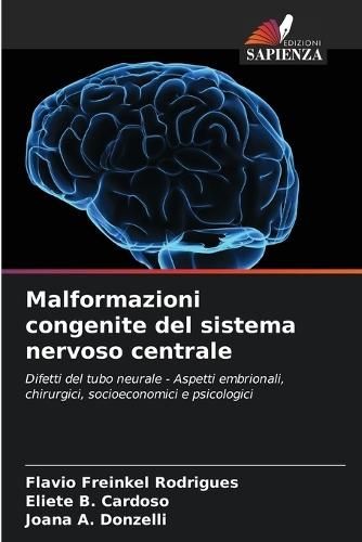 Malformazioni congenite del sistema nervoso centrale
