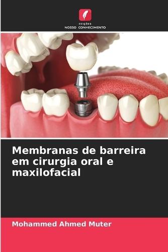 Membranas de barreira em cirurgia oral e maxilofacial