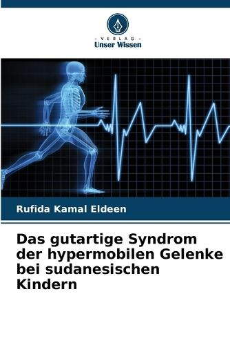 Das gutartige Syndrom der hypermobilen Gelenke bei sudanesischen Kindern