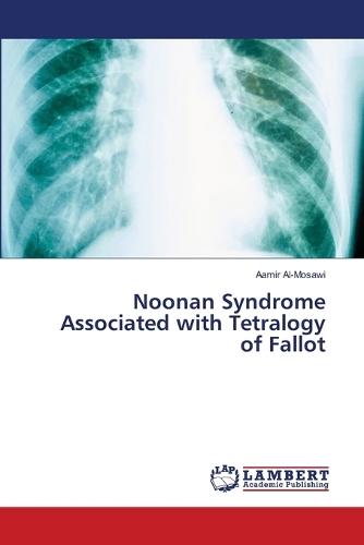Noonan Syndrome Associated with Tetralogy of Fallot