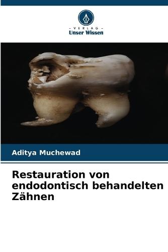 Restauration von endodontisch behandelten Zähnen