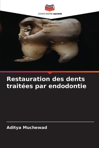 Restauration des dents traitées par endodontie