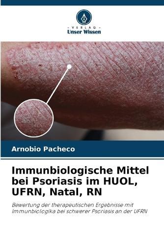 Immunbiologische Mittel bei Psoriasis im HUOL, UFRN, Natal, RN