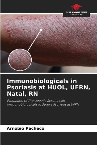Immunobiologicals in Psoriasis at HUOL, UFRN, Natal, RN