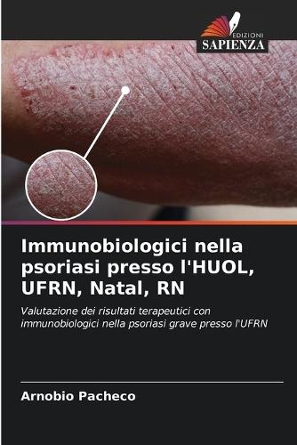Immunobiologici nella psoriasi presso l'HUOL, UFRN, Natal, RN