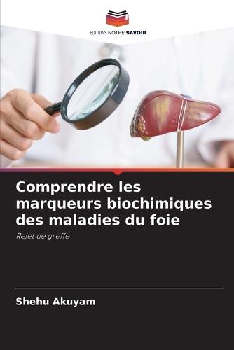 Comprendre les marqueurs biochimiques des maladies du foie