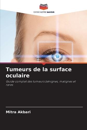 Tumeurs de la surface oculaire