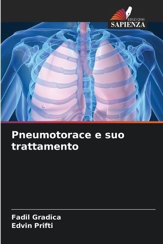 Pneumotorace e suo trattamento