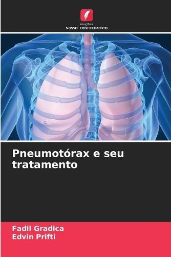 Pneumotórax e seu tratamento