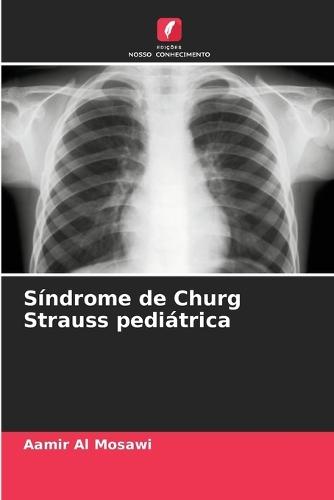 Síndrome de Churg Strauss pediátrica