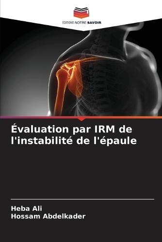 Évaluation par IRM de l'instabilité de l'épaule