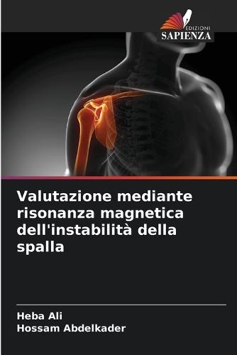 Valutazione mediante risonanza magnetica dell'instabilità della spalla