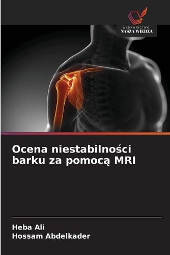 Ocena niestabilności barku za pomocą MRI