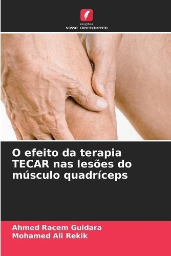 O efeito da terapia TECAR nas lesões do músculo quadríceps