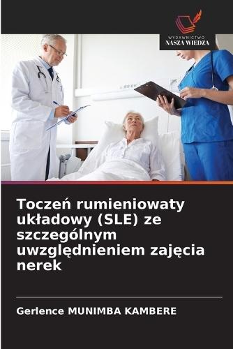 Toczeń rumieniowaty ukladowy (SLE) ze szczególnym uwzględnieniem zajęcia nerek