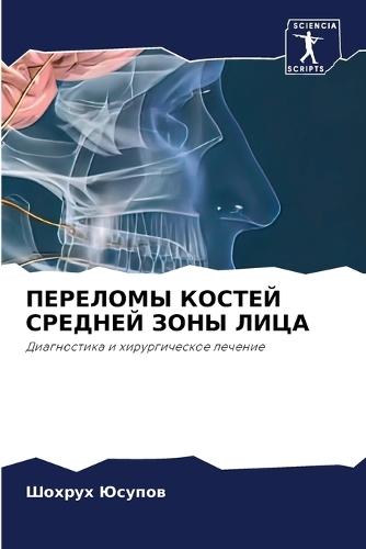 ПЕРЕЛОМЫ КОСТЕЙ СРЕДНЕЙ ЗОНЫ ЛИЦА