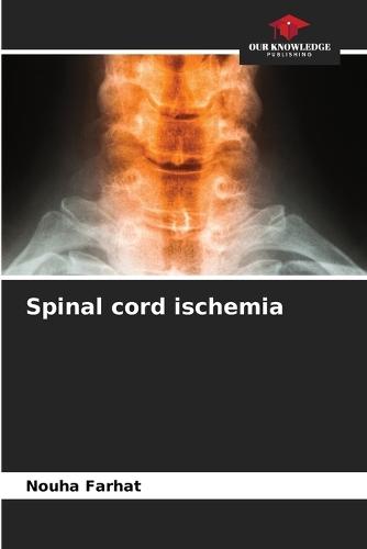 Spinal cord ischemia