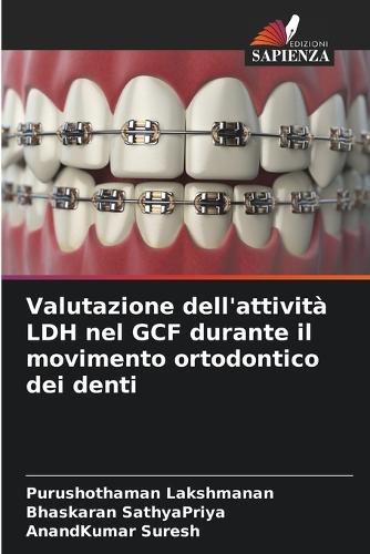 Valutazione dell'attività LDH nel GCF durante il movimento ortodontico dei denti