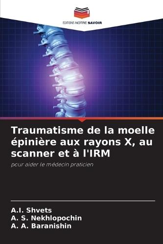 Traumatisme de la moelle épinière aux rayons X, au scanner et à l'IRM