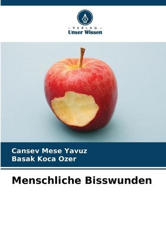 Menschliche Bisswunden