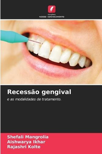 Recessão gengival