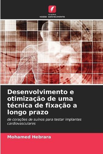 Desenvolvimento e otimização de uma técnica de fixação a longo prazo