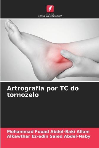 Artrografia por TC do tornozelo