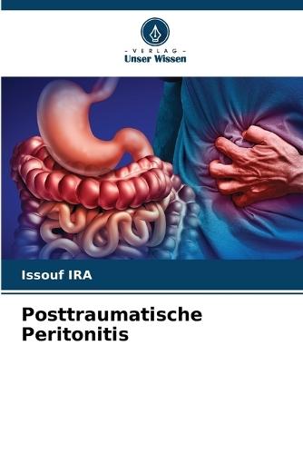 Posttraumatische Peritonitis