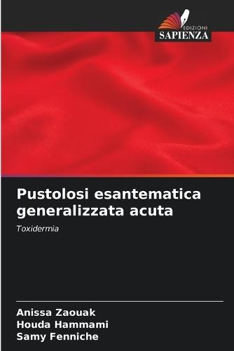 Pustolosi esantematica generalizzata acuta