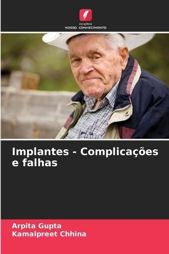 Implantes - Complicações e falhas