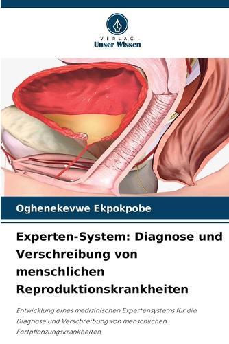 Experten-System: Diagnose und Verschreibung von menschlichen Reproduktionskrankheiten