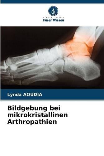 Bildgebung bei mikrokristallinen Arthropathien