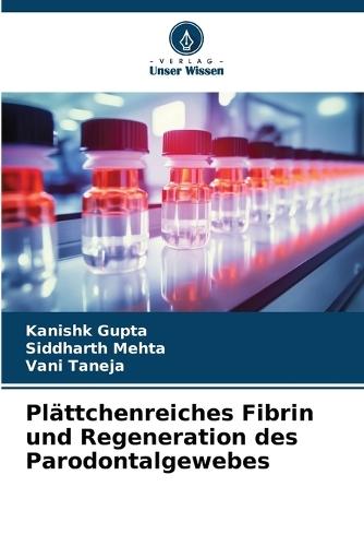 Plättchenreiches Fibrin und Regeneration des Parodontalgewebes