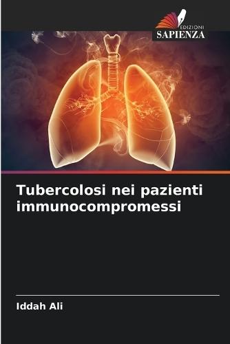 Tubercolosi nei pazienti immunocompromessi