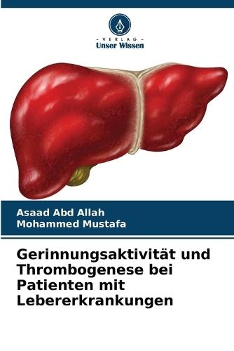 Gerinnungsaktivität und Thrombogenese bei Patienten mit Lebererkrankungen