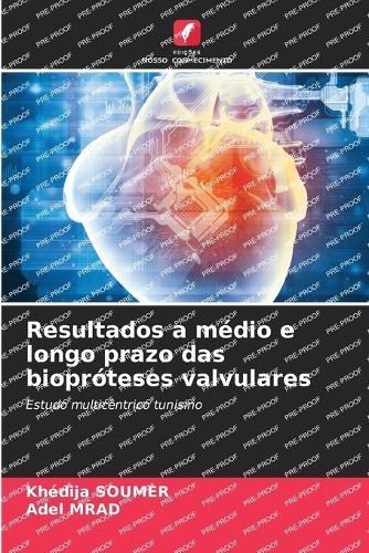 Resultados a médio e longo prazo das biopróteses valvulares