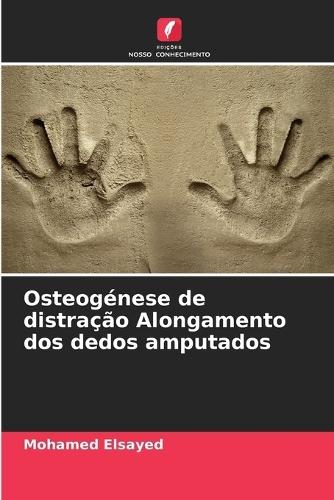 Osteogénese de distração Alongamento dos dedos amputados
