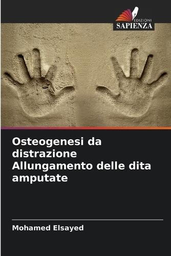 Osteogenesi da distrazione Allungamento delle dita amputate