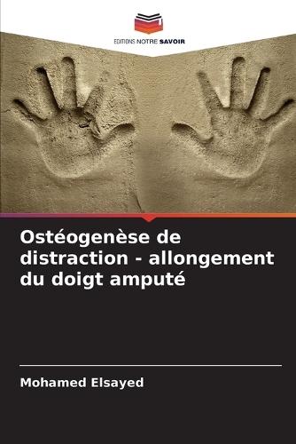 Ostéogenèse de distraction - allongement du doigt amputé