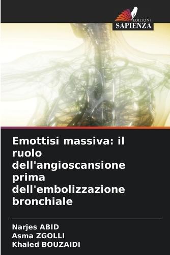 Emottisi massiva: il ruolo dell'angioscansione prima dell'embolizzazione bronchiale