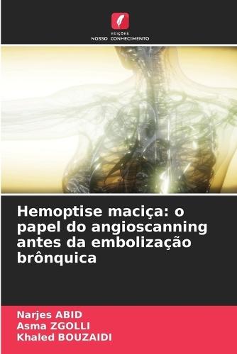 Hemoptise maciça: o papel do angioscanning antes da embolização brônquica