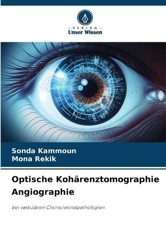 Optische Kohärenztomographie Angiographie