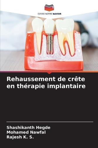 Rehaussement de crête en thérapie implantaire