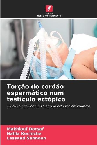 Torção do cordão espermático num testículo ectópico
