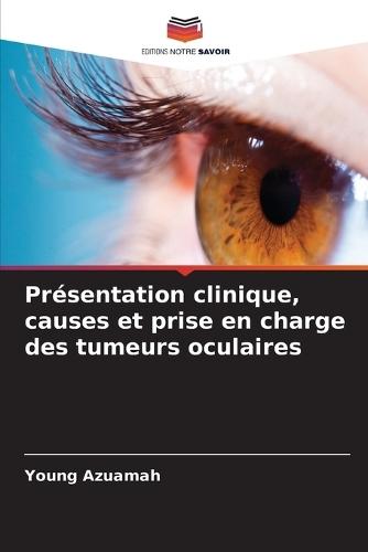 Présentation clinique, causes et prise en charge des tumeurs oculaires